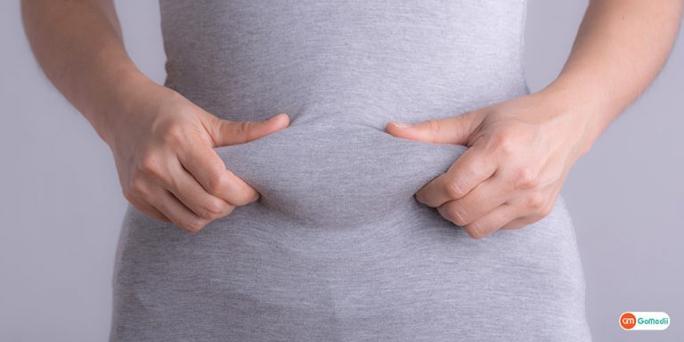 The Link Between Estrogen and Weight Gain