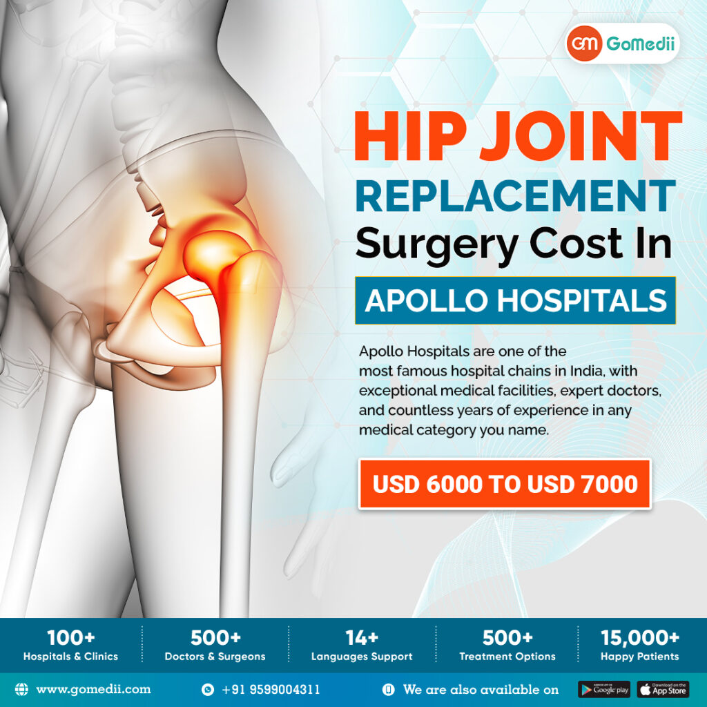 Hip Joint Replacement Surgery Cost In Apollo Hospitals GoMedii