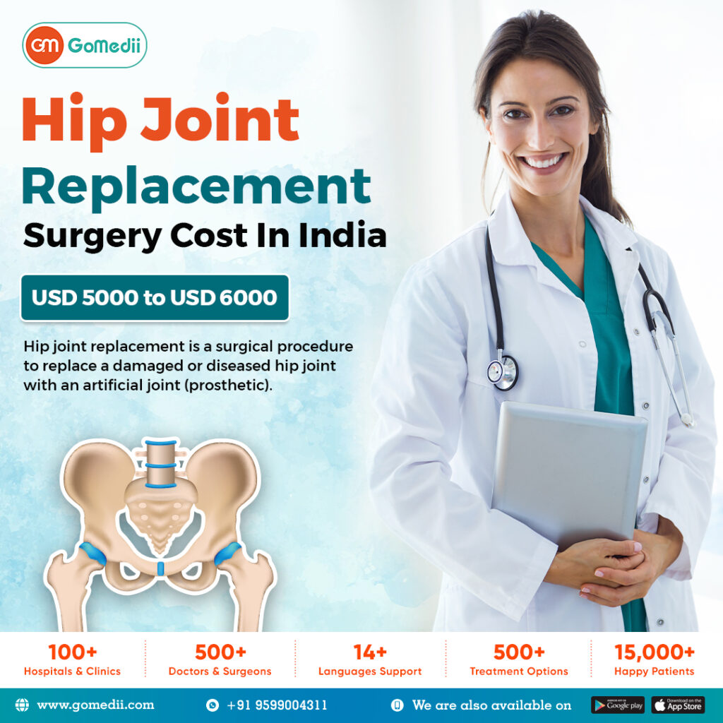 What Is The Hip Joint Replacement Surgery Cost In India? GoMedii