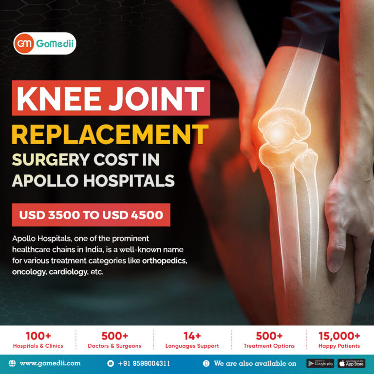 Knee Joint Replacement Surgery Cost In Apollo Hospitals