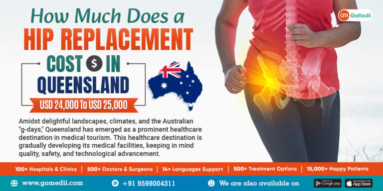 How Much Does A Hip Replacement Cost In Queensland? - GoMedii Blog